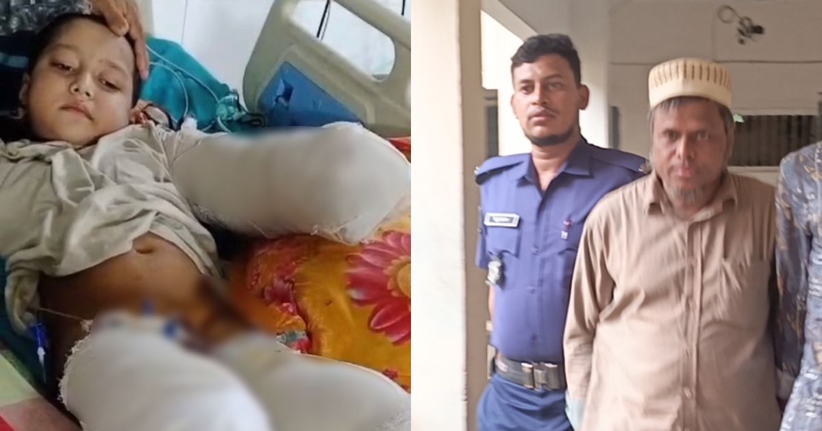 Child-Tanvir-became-crippled-by-Sacmo-Shafiqs-wrong-treatment