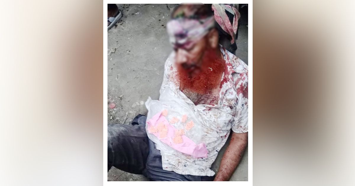 Beaten-by-a-drug-dealer