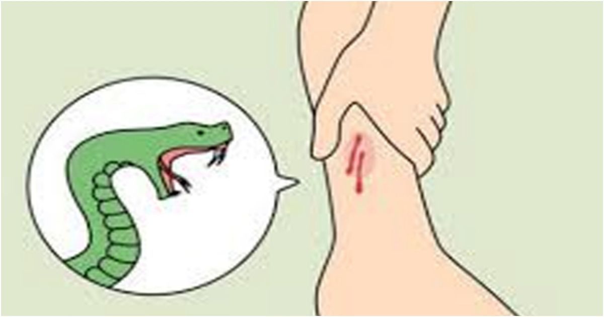 Snake-bite-in-Gangni-in-Meherpur