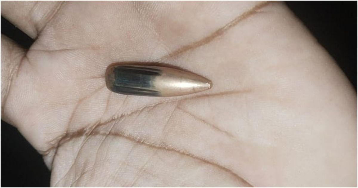 Woman-injured-in-Teknaf-firing-from-Myanmar-fear-at-the-border