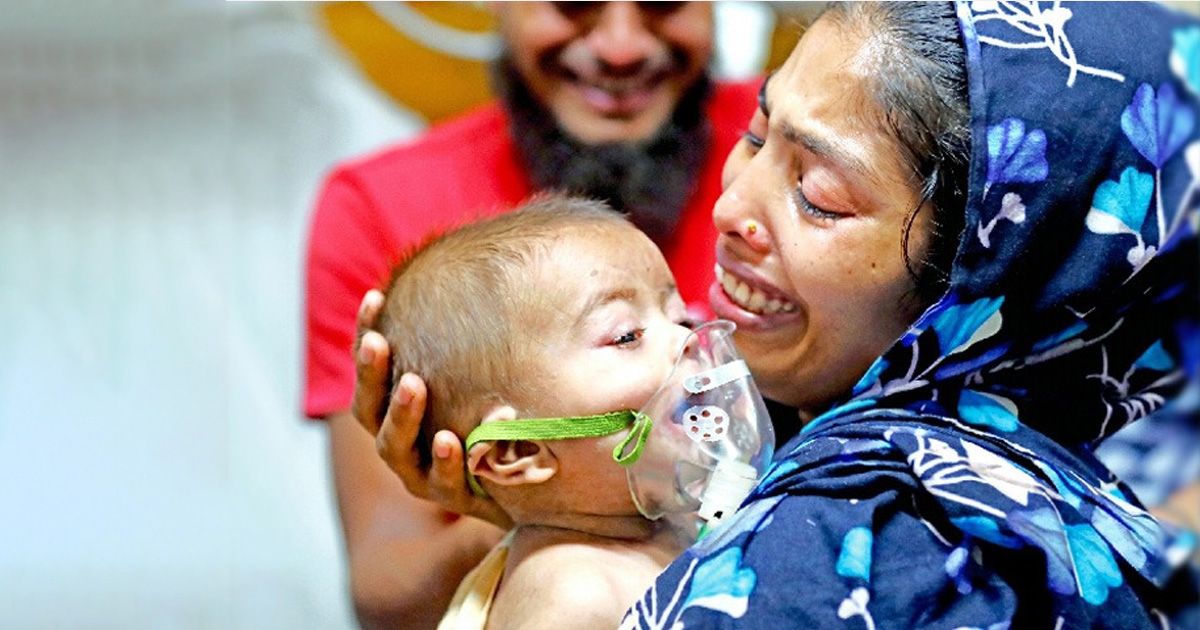 ২৪ ঘণ্টায় দেশে হাম ও হামের উপসর্গ নিয়ে ১৭ শিশুর মৃত্যু