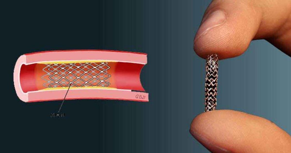 The-government-ordered-the-sale-of-heart-rings-at-new-prices
