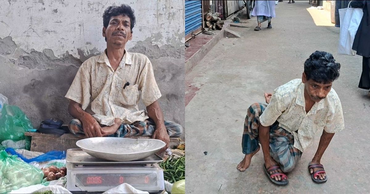 দুই পা হারিয়েও হারেননি মনোবল, লড়াই করে বাঁচছেন আজগর