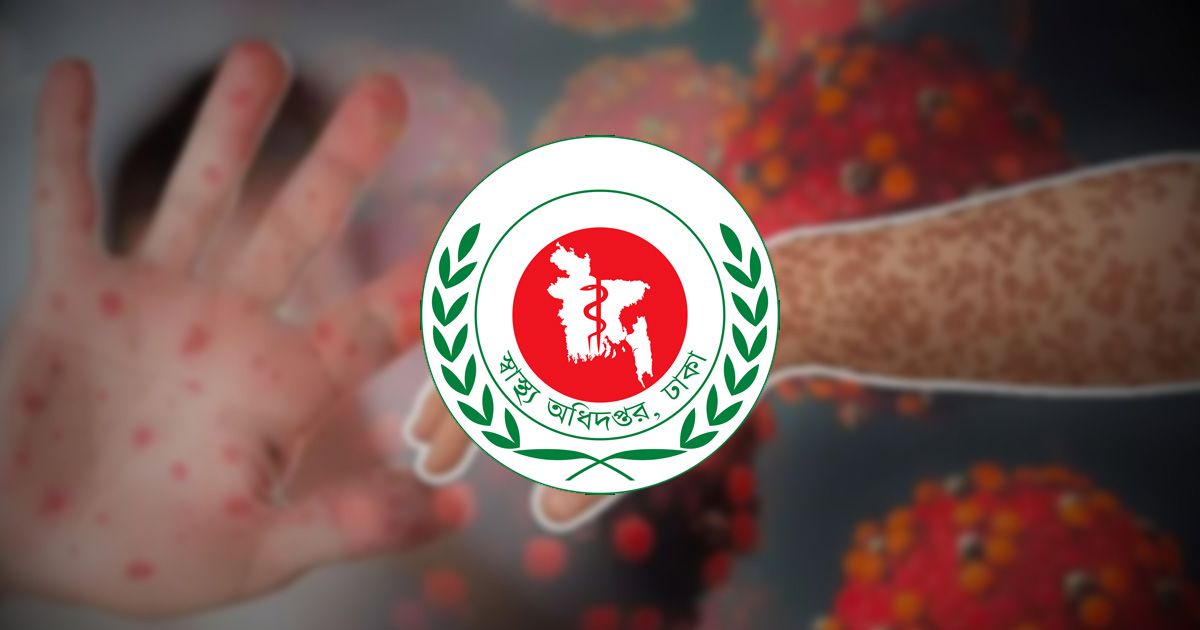 Five-more-children-died-of-measles-symptoms-in-the-country