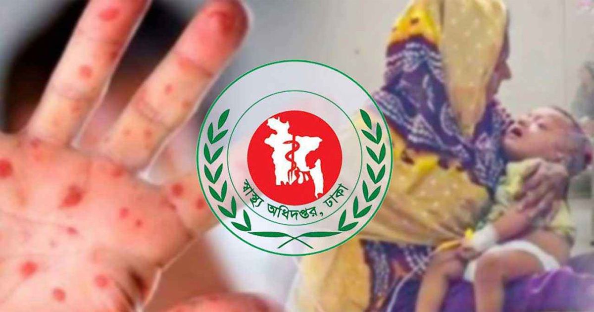 8-deaths-in-one-day-in-measles-dengue-are-increasing-concern
