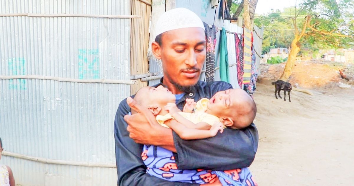 Family-appeals-for-help-to-save-life-of-conjoined-twin-girls
