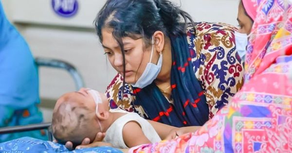 হাম উপসর্গে আরও ২ জনের মৃত্যু